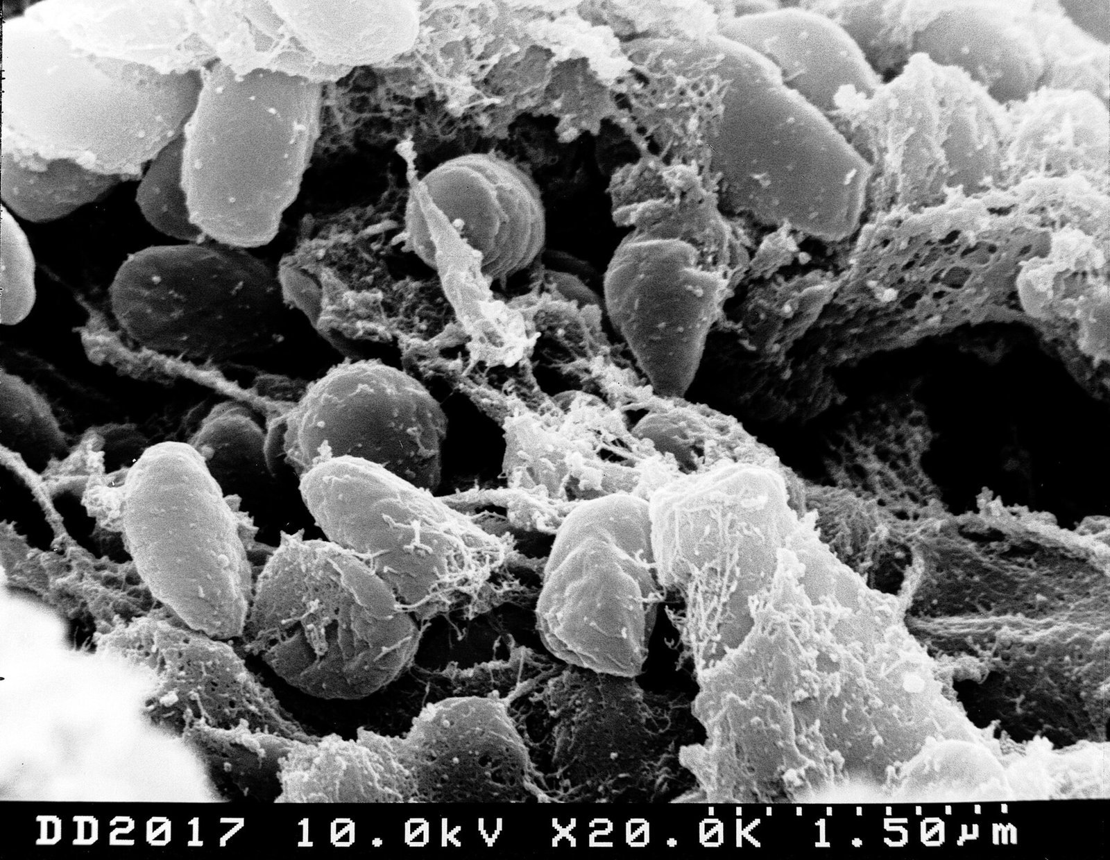 Electron microscope image of plague bacteria, Yersinia pestis, packed inside a flea's gut