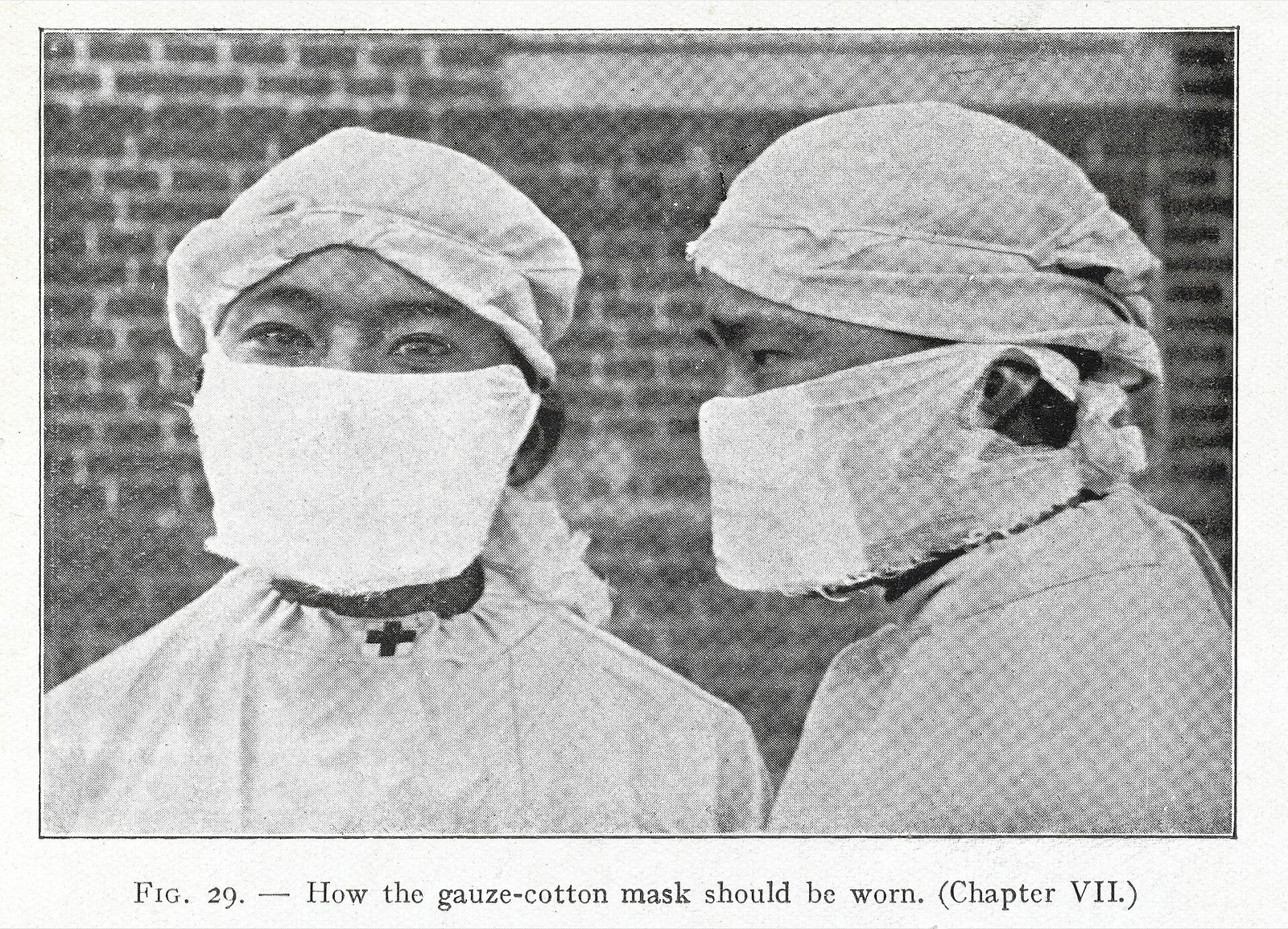An old medical book drawing showing how a gauze and cotton plague mask should be tied over the nose and mouth