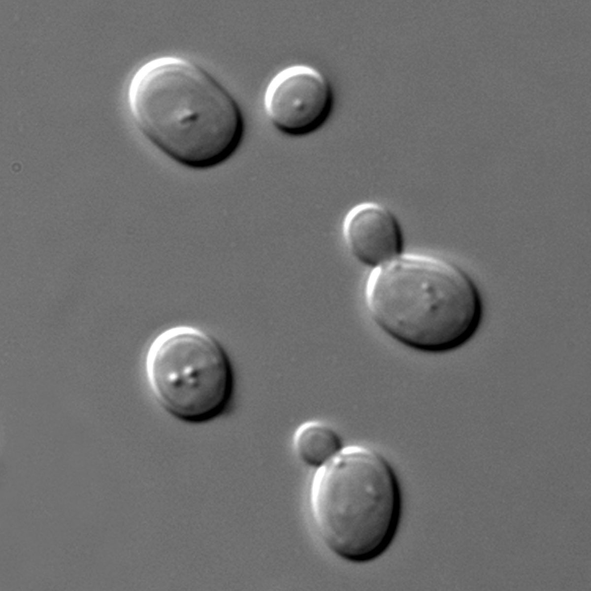 Yeast cells seen under a microscope