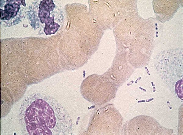 Plague bacteria under a microscope, stained so each one has dark tips like a tiny safety pin